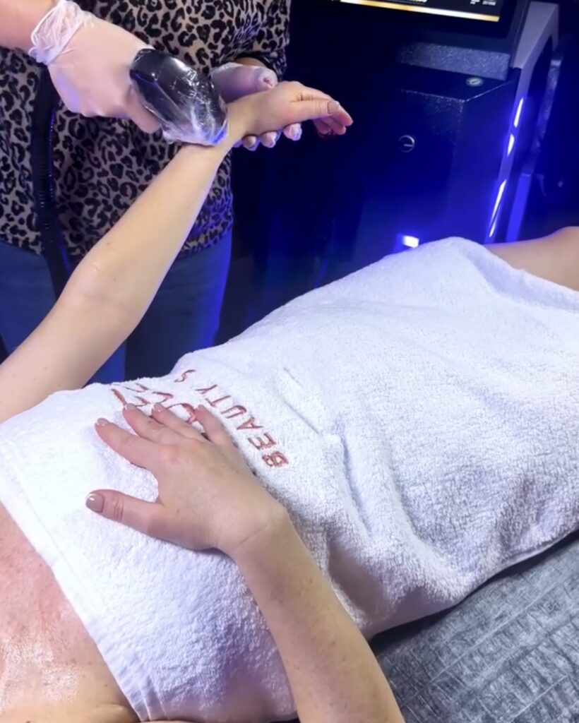 Kibele Beauty Studio Ankara Balgat lazer epilasyon uygulama anı